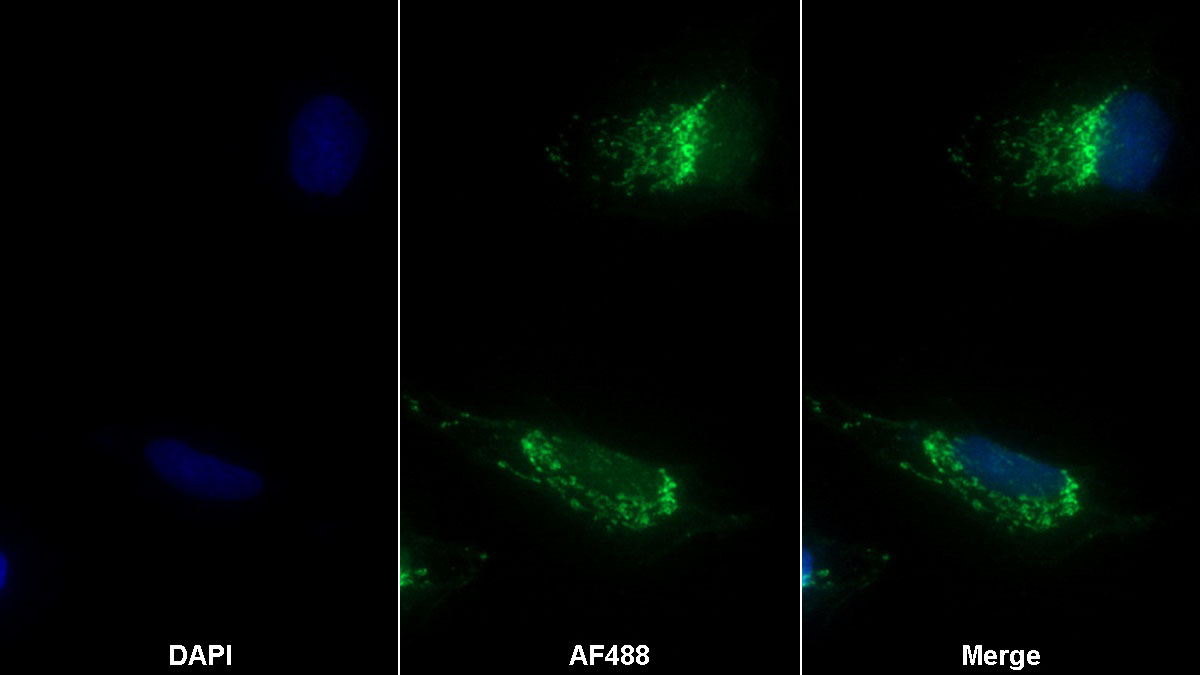 Polyclonal Antibody to Tachykinin Receptor 2 (TACR2)