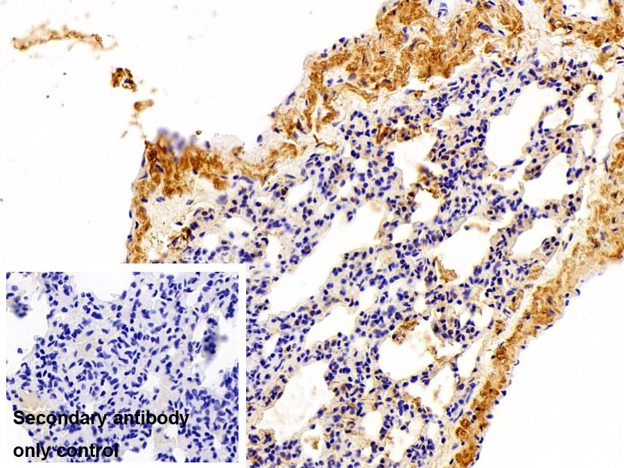 Polyclonal Antibody to Glutathione S Transferase Theta 1 (GSTt1)