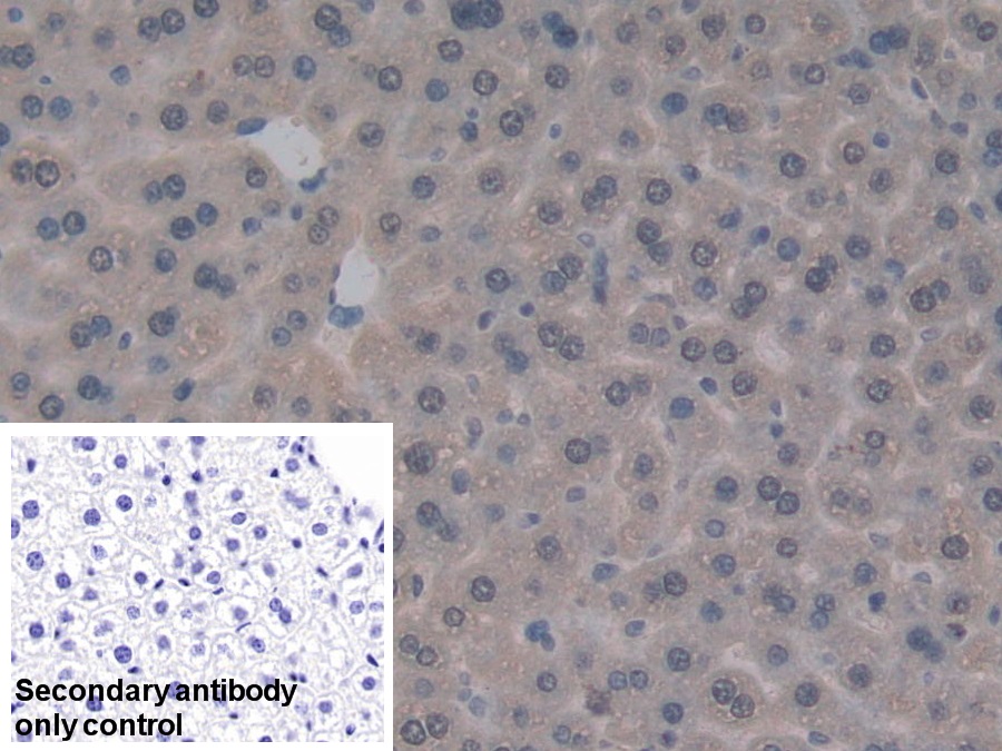 Polyclonal Antibody to Glutathione S Transferase Theta 1 (GSTt1)