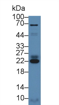 Polyclonal Antibody to Glutathione S Transferase Theta 1 (GSTt1)