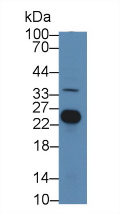 Polyclonal Antibody to Glutathione S Transferase Theta 1 (GSTt1)