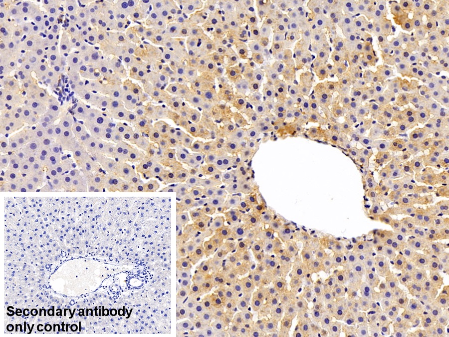 Polyclonal Antibody to Glutathione S Transferase Theta 1 (GSTt1)