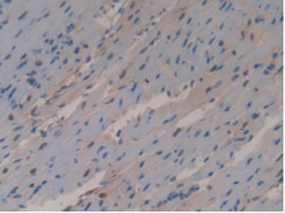 Polyclonal Antibody to Glutathione S Transferase Omega 1 (GSTo1)