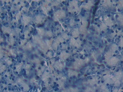 Polyclonal Antibody to Glutathione S Transferase Omega 1 (GSTo1)