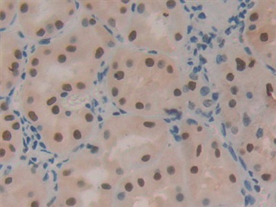 Polyclonal Antibody to Hepatoma Derived Growth Factor (HDGF)