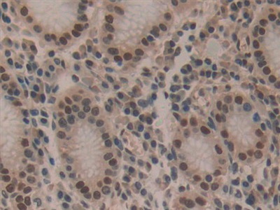 Polyclonal Antibody to Hepatoma Derived Growth Factor (HDGF)