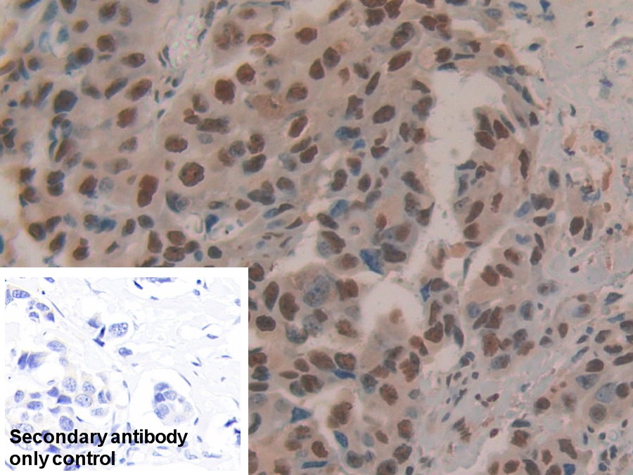 Polyclonal Antibody to Hepatoma Derived Growth Factor (HDGF)