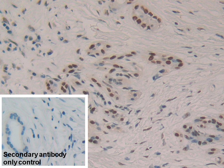 Polyclonal Antibody to Hepatoma Derived Growth Factor (HDGF)