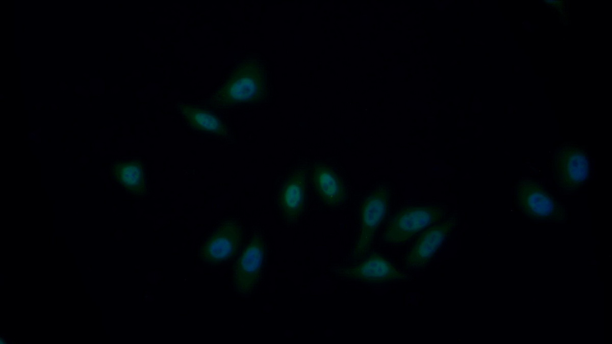 Polyclonal Antibody to Hepatoma Derived Growth Factor (HDGF)