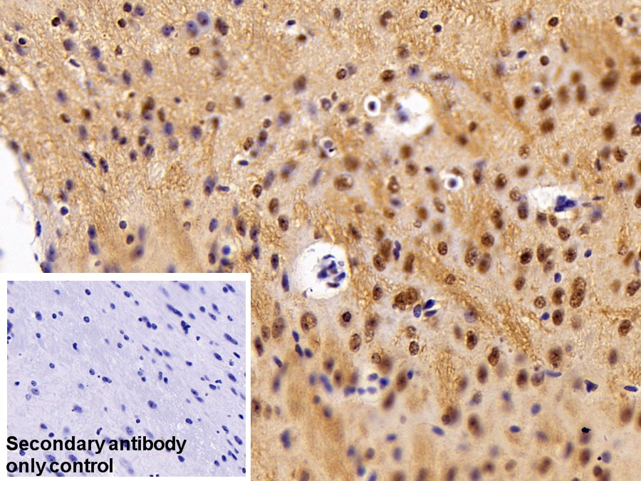 Polyclonal Antibody to Hepatoma Derived Growth Factor (HDGF)