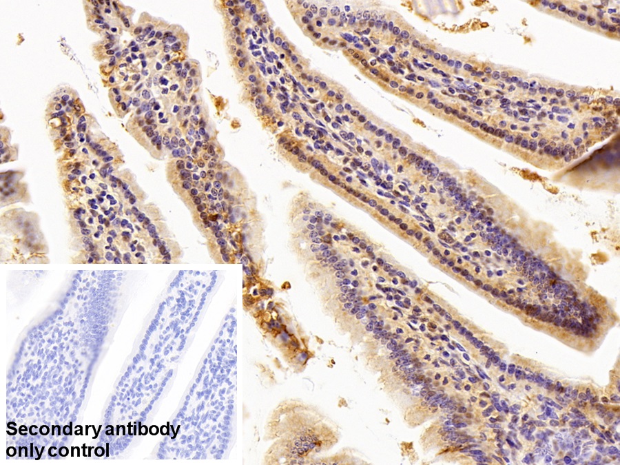 Polyclonal Antibody to Hepatoma Derived Growth Factor (HDGF)