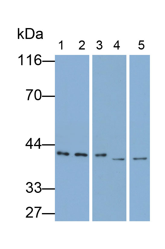 Polyclonal Antibody to Hepatoma Derived Growth Factor (HDGF)