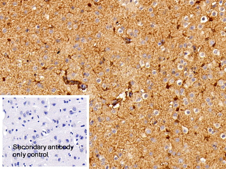 Polyclonal Antibody to Chemokine C-X-C-Motif Receptor 3 (CXCR3)