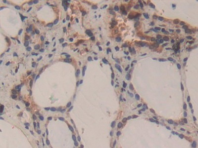 Polyclonal Antibody to Caspase 3 (CASP3)