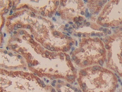 Polyclonal Antibody to Caspase 3 (CASP3)