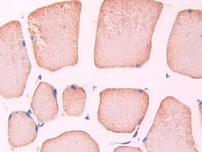 Polyclonal Antibody to Nitric Oxide Synthase Trafficker (NOSTRIN)