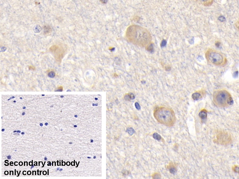 Polyclonal Antibody to BH3 Interacting Domain Death Agonist (Bid)