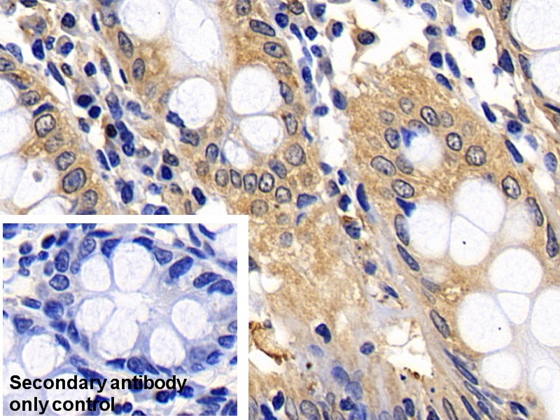 Polyclonal Antibody to BH3 Interacting Domain Death Agonist (Bid)