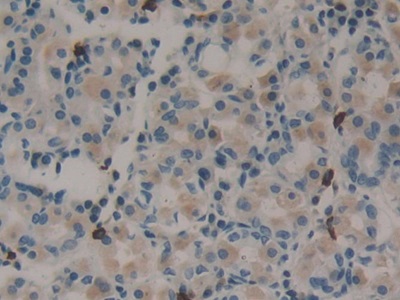 Polyclonal Antibody to Midkine (MK)