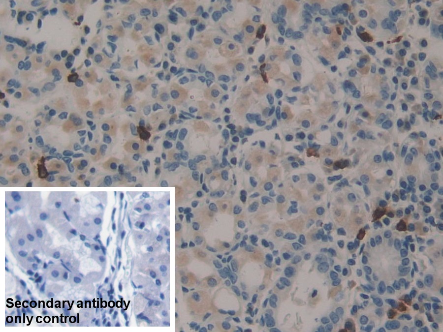 Polyclonal Antibody to Midkine (MK)