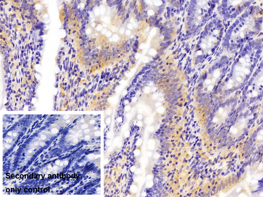 Polyclonal Antibody to Midkine (MK)