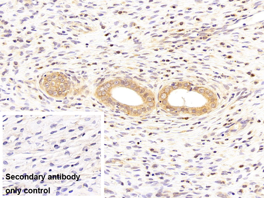 Polyclonal Antibody to Midkine (MK)