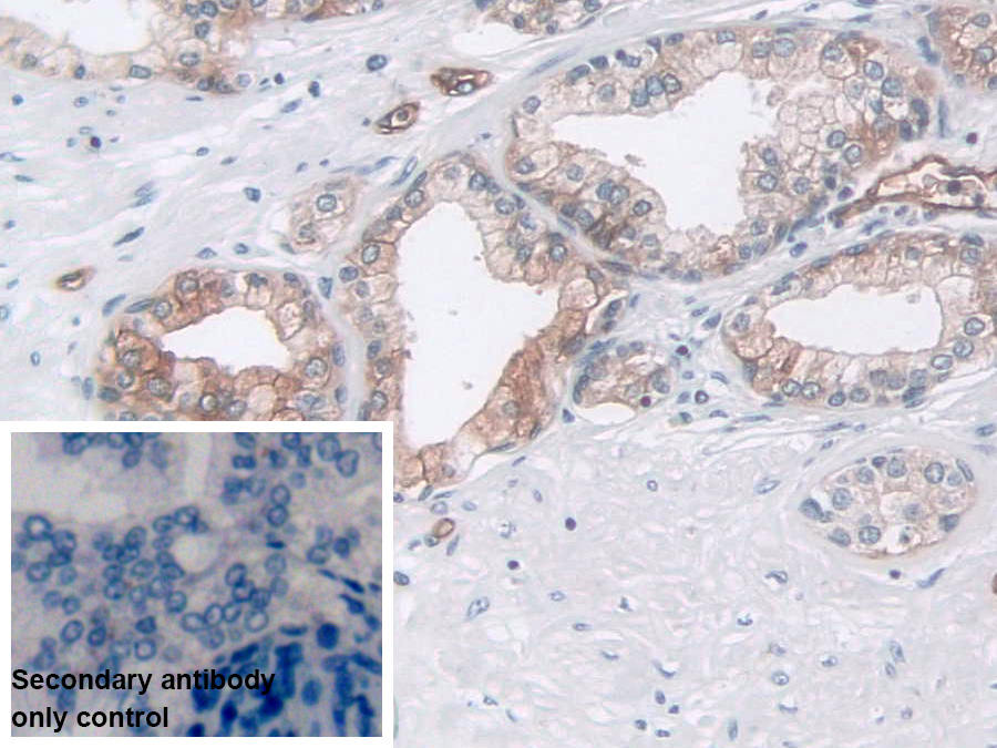 Polyclonal Antibody to Pepsin (PP)