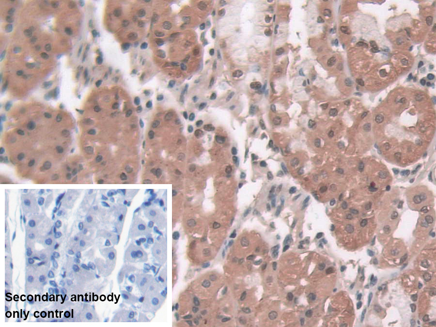 Polyclonal Antibody to Pepsin (PP)