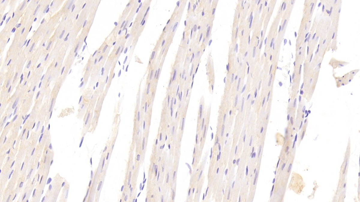 Polyclonal Antibody to Platelet Derived Growth Factor BB (PDGF BB)