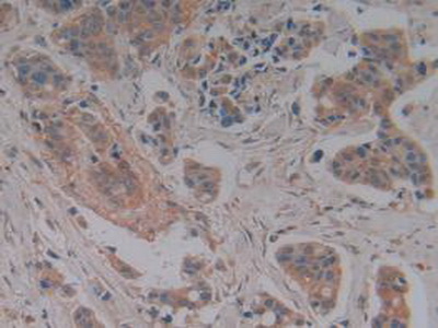 Polyclonal Antibody to Complement Factor H (CFH)