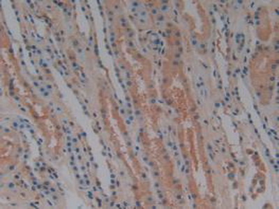 Polyclonal Antibody to Complement Factor H (CFH)