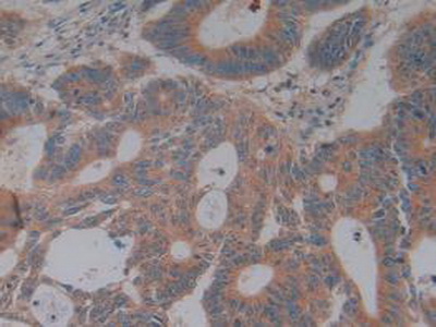 Polyclonal Antibody to Complement Factor H (CFH)