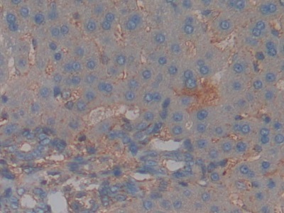 Polyclonal Antibody to Complement Factor H (CFH)