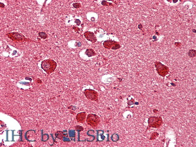 Polyclonal Antibody to Hexosaminidase B Beta (HEXb)