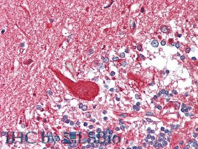 Polyclonal Antibody to Hexosaminidase B Beta (HEXb)