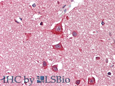 Polyclonal Antibody to Hexosaminidase B Beta (HEXb)