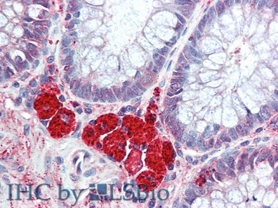 Polyclonal Antibody to Hexosaminidase B Beta (HEXb)