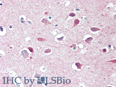 Polyclonal Antibody to Hexosaminidase B Beta (HEXb)