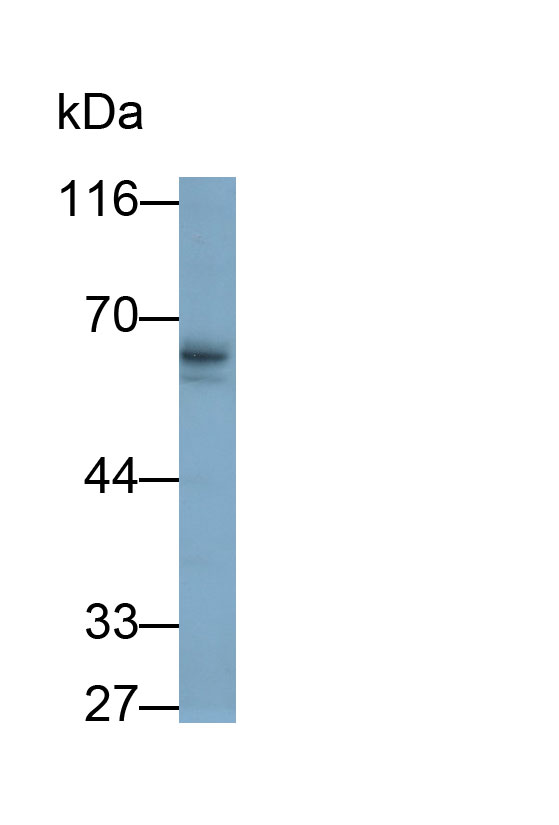 Polyclonal Antibody to Hexosaminidase B Beta (HEXb)