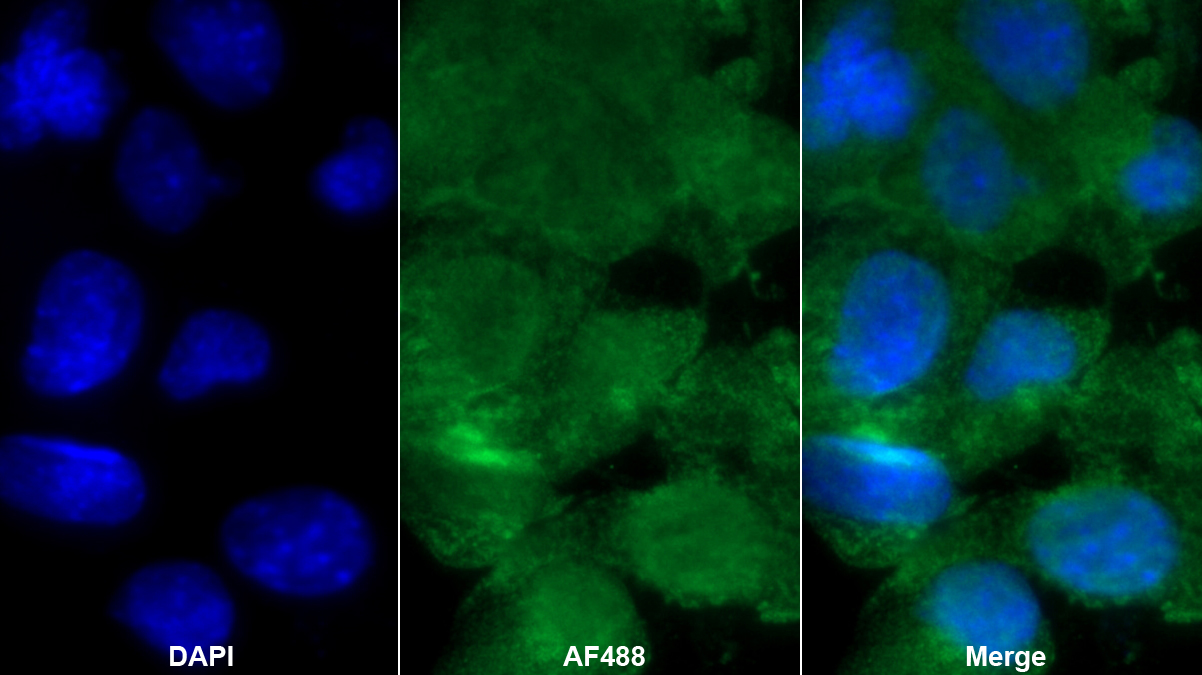 Polyclonal Antibody to Hexosaminidase B Beta (HEXb)