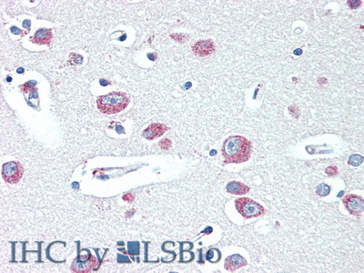 Polyclonal Antibody to Hexosaminidase B Beta (HEXb)