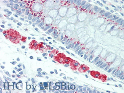 Polyclonal Antibody to Hexosaminidase B Beta (HEXb)