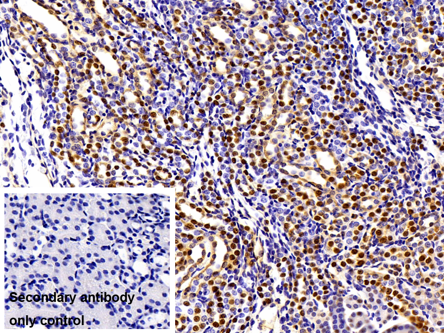 Polyclonal Antibody to Visfatin (VF)