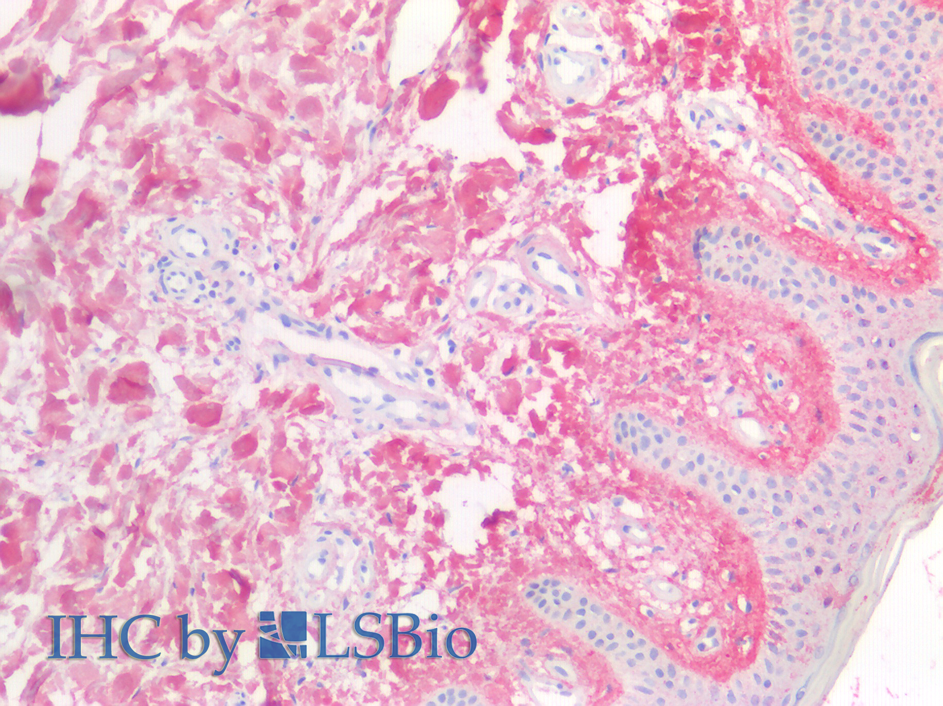 Polyclonal Antibody to Cross Linked N-Telopeptide Of Type I Collagen (NTXI)