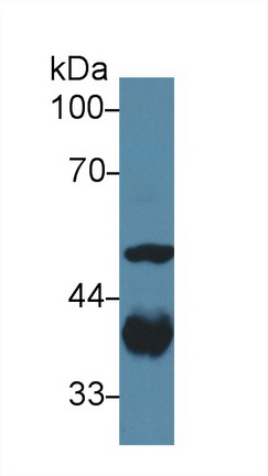 Polyclonal Antibody to Aldolase A, Fructose Bisphosphate (ALDOA)