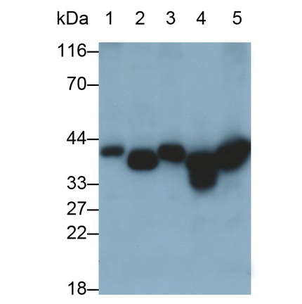 Polyclonal Antibody to Aldolase A, Fructose Bisphosphate (ALDOA)