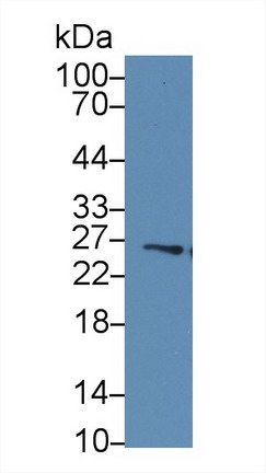 Polyclonal Antibody to Glutathione S Transferase Mu 4 (GSTm4)