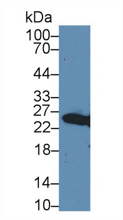 Polyclonal Antibody to Glutathione S Transferase Mu 4 (GSTm4)