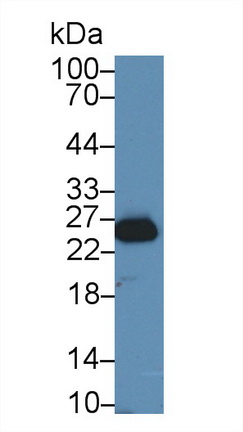 Polyclonal Antibody to Glutathione S Transferase Mu 4 (GSTm4)