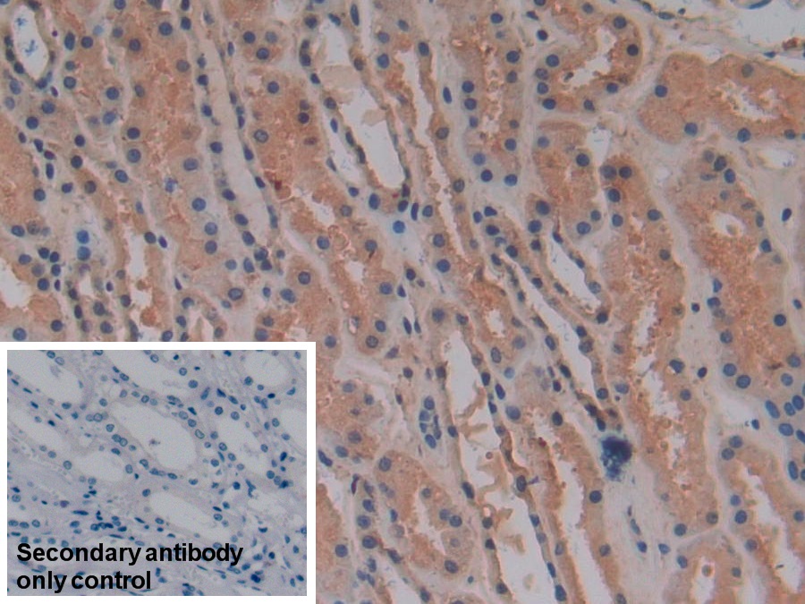 Polyclonal Antibody to Glutathione S Transferase Mu 4 (GSTm4)